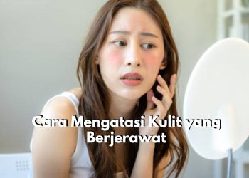 6 Tips Ini Bisa Kamu Coba untuk Atasi Jerawat yang Membandel, Cukup Bersihkan Wajah dengan Rutin