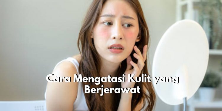 6 Tips Ini Bisa Kamu Coba untuk Atasi Jerawat yang Membandel, Cukup Bersihkan Wajah dengan Rutin