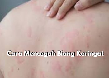 Cegah Sebelum Terjadi! Ini Beberapa Tips yang Bisa Dicoba untuk Mencegah Biang Keringat Pada Kulit