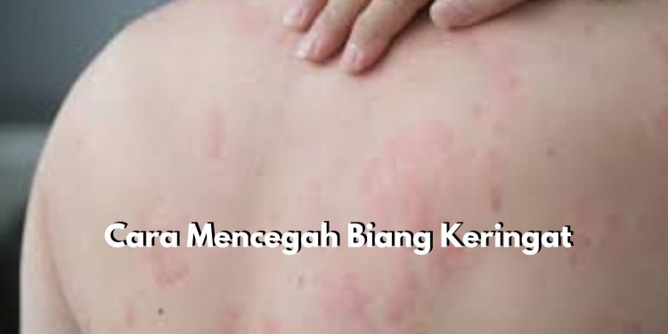 Cegah Sebelum Terjadi! Ini Beberapa Tips yang Bisa Dicoba untuk Mencegah Biang Keringat Pada Kulit