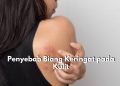 Kurangnya Kebersihan Kulit Menjadi Salah Satu Penyebab Biang Keringat, Cek 5 Penyebab Lainnya Disini!