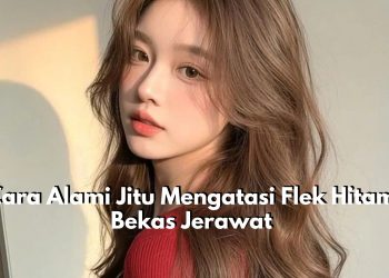 5 Cara Alami Jitu Mengatasi Flek Hitam Bekas Jerawat, Wajah Auto Glowing dan Segar