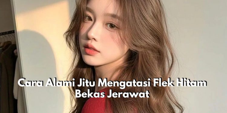 5 Cara Alami Jitu Mengatasi Flek Hitam Bekas Jerawat, Wajah Auto Glowing dan Segar