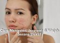 Cara Mengatasi Jerawat di Wajah Secara Efektif, Ini 5 Rekomendasi Bahan Alami yang Tepat