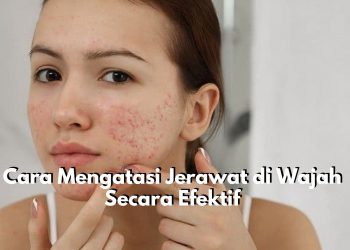 Cara Mengatasi Jerawat di Wajah Secara Efektif, Ini 5 Rekomendasi Bahan Alami yang Tepat