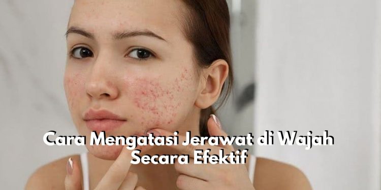 Cara Mengatasi Jerawat di Wajah Secara Efektif, Ini 5 Rekomendasi Bahan Alami yang Tepat