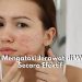 Cara Mengatasi Jerawat di Wajah Secara Efektif, Ini 5 Rekomendasi Bahan Alami yang Tepat