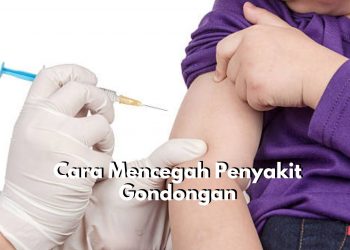 Tetap Wasapada! Coba Lakukan 6 Cara Ini untuk Cegah Penyakit Gondongan, Dijamin Efektif dan Mudah Dilakukan