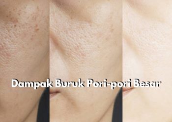 Jangan Anggap Sepele! Kenali Dampak Buruk Pori-pori Besar di Wajah, Bikin Berjerawat hingga Timbul Komedo