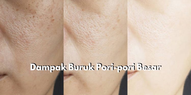 Jangan Anggap Sepele! Kenali Dampak Buruk Pori-pori Besar di Wajah, Bikin Berjerawat hingga Timbul Komedo