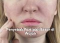 Waspadai! Ada 5 Penyebab Utama yang Bisa Memicu Pori-pori Besar di Wajah, Salah Satunya Produksi Minyak Berlebih