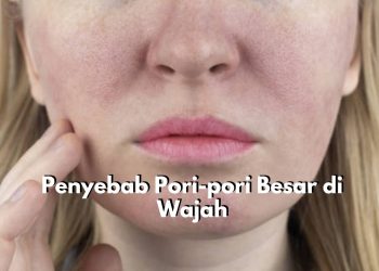 Waspadai! Ada 5 Penyebab Utama yang Bisa Memicu Pori-pori Besar di Wajah, Salah Satunya Produksi Minyak Berlebih