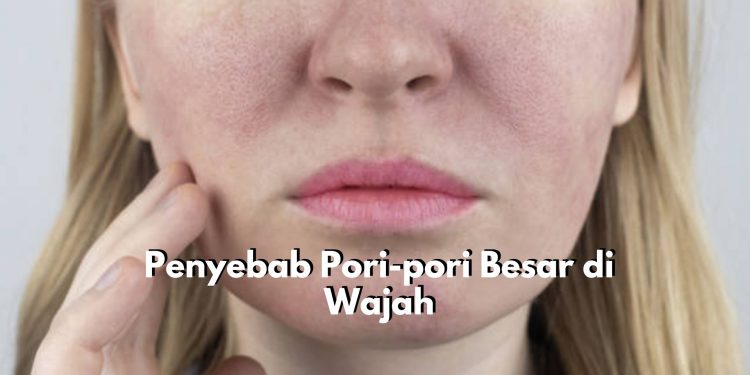 Waspadai! Ada 5 Penyebab Utama yang Bisa Memicu Pori-pori Besar di Wajah, Salah Satunya Produksi Minyak Berlebih
