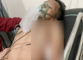 Begal Berulah Lagi! Satpam DPRD Pemrov Jadi Korban, Bercucuran Darah Akibat Tusukan Senjata Tajam