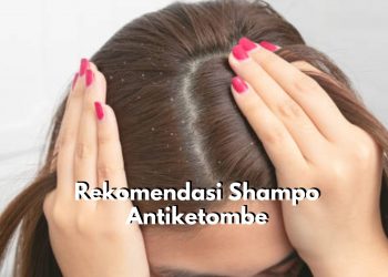 Berikut Ada 5 Rekomendasi Produk Shampo yang Ampuh untuk Atasi Ketombe di Rambut, Salah Satunya Pantene Shampoo Anti Dandruff