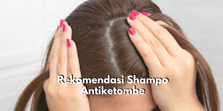 Berikut Ada 5 Rekomendasi Produk Shampo yang Ampuh untuk Atasi Ketombe di Rambut, Salah Satunya Pantene Shampoo Anti Dandruff