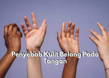 Bukan Hanya Karena Paparan Sinar Matahari! Inilah Sederet Penyebab Kulit Belang Pada Tangan