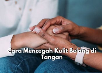 Buktikan Sendiri! Ini 6 Cara untuk Cegah Kulit Belang di Tangan, Mulailah dengan Perhatikan Gaya Hidup dan Pola Makan