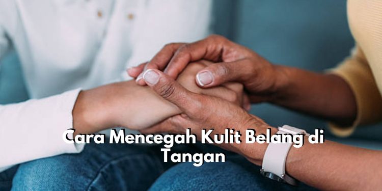 Buktikan Sendiri! Ini 6 Cara untuk Cegah Kulit Belang di Tangan, Mulailah dengan Perhatikan Gaya Hidup dan Pola Makan