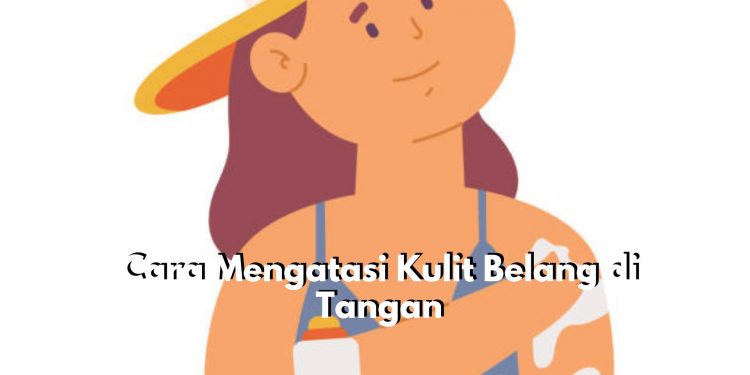 Coba Lakukan Ini! Intip Disini 6 Cara Efektif Atasi Kulit Belang di Tangan, Mulailah dengan Gunakan Sunscreen