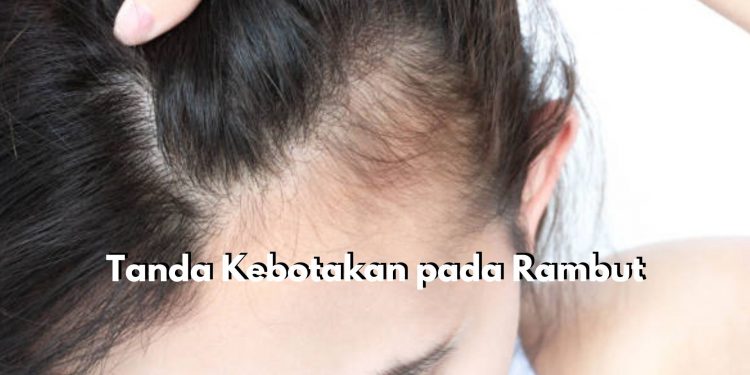 Waspada! 7 Tanda Ini dapat Memicu Kebotakan pada Rambut, Apa Saja?