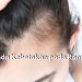 Waspada! 7 Tanda Ini dapat Memicu Kebotakan pada Rambut, Apa Saja?