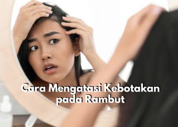 Jangan Panik, Coba Lakukan 6 Cara Ini untuk Atasi Kebotakan Pada Rambut, Dijamin Ampuh!