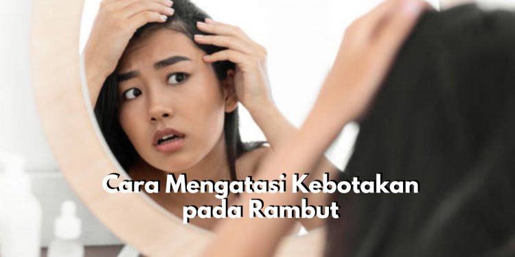 Jangan Panik, Coba Lakukan 6 Cara Ini untuk Atasi Kebotakan Pada Rambut, Dijamin Ampuh!