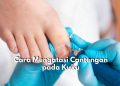 Sering Alami Kuku Cantengan? Coba Atasi dengan 5 Cara Ini, Salah Satunya Gunakan Obat Antiseptik atau Salep Antibiotik