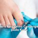 Sering Alami Kuku Cantengan? Coba Atasi dengan 5 Cara Ini, Salah Satunya Gunakan Obat Antiseptik atau Salep Antibiotik