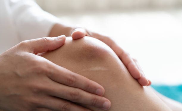 Inilah Rekomendasi Obat Herbal untuk Atasi Memar pada Tubuh, Ada Arnica hingga Jahe Bisa