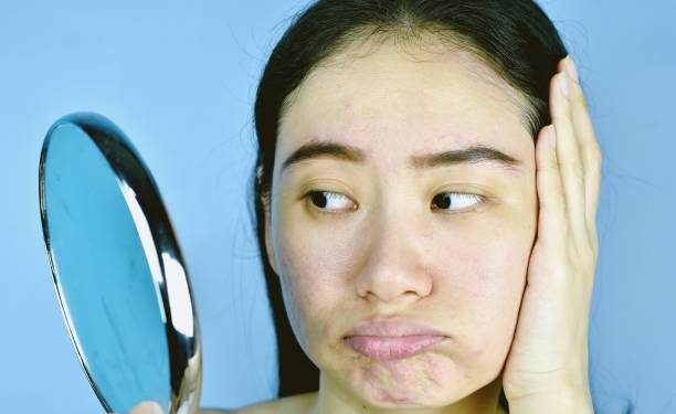 Kulit Kusam Bikin Percaya Diri Berkurang? Coba Atasi dengan 6 Langkah Tepat Urutan Skincare Ini, Cek!