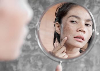 Kulit Wajahmu Ada Flek Hitam Menaun? Coba Atasi dengan Beberapa Rekomendasi Masker Buah Ini, Dijamin Auto Glowing Merata