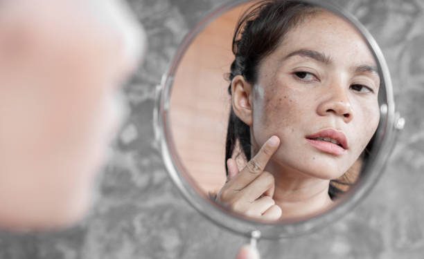 Kulit Wajahmu Ada Flek Hitam Menaun? Coba Atasi dengan Beberapa Rekomendasi Masker Buah Ini, Dijamin Auto Glowing Merata