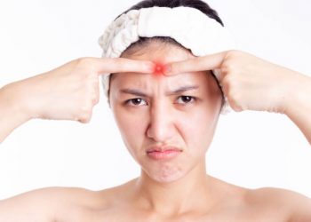 Ternyata Ini Segudang Penyebab yang Bisa Memicu Timbulnya Jerawat Batu di Wajah, Utamanya Perubahan Hormon