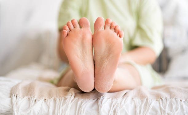 6 Rekomendasi Salep yang Ampuh Atasi Tumit Kaki Pecah-pecah, Ada Hansaplast Foot Cream 10% Urea hingga Dermatix Heel Balm