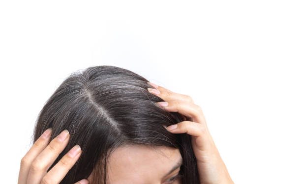 Adanya Uban pada Rambut Ternyata Bisa Tumbuh Banyak dalam Semalam, Apakah Ini Mitos?