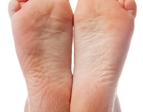 Ingin Tumit Kaki Tetap Mulus Tanpa Pecah-pecah? Ini Beberapa Cara yang Bisa Kamu Terapkan, Cek Sekarang Juga!