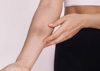 Sering Alami Memar Tanpa Sebab? Ternyata Ini 6 Penyebabnya, Yuk Mari Dilihat!