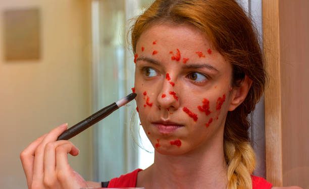 Raih Kecantikan Kulit Secara Alami dengan Gunakan Perawatan dari Buah Semangka, Cek Manfaatnya Disini!