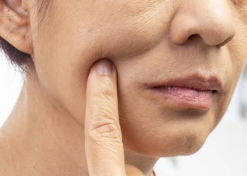 Kamu Pemilik Kulit Kering? Jangan Biarkan Gitu Aja, Coba Atasi dengan  3 Cara Simpel Ini!