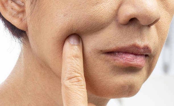 Kamu Pemilik Kulit Kering? Jangan Biarkan Gitu Aja, Coba Atasi dengan  3 Cara Simpel Ini!