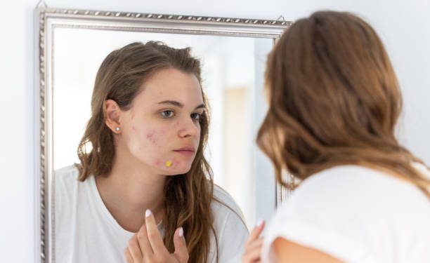 Kulitmu Sensitif? Terapkan 6 Tips Ini untuk Memilih Skincare, Ingat Jangan Asal-asalan!