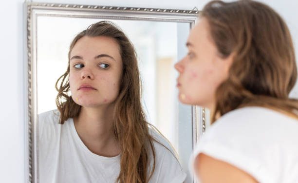 Wajib Tahu! Pemilik Kulit Sensitif Perlu Menghindari 6 Bahan Skincare Ini, Apa Saja?