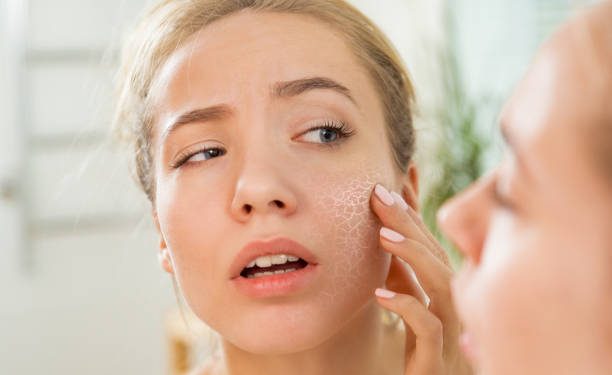 5 Produk Sunscreen Ini Cocok Dipakai untuk Pemilik Kulit Kering, Apa Saja?