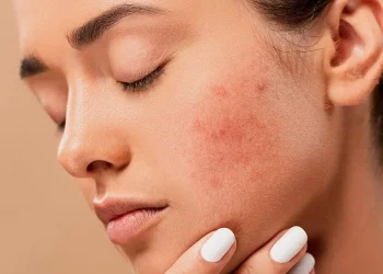 Ini 5 Ciri Kulit Sensitif yang Perlu Diketahui, Salah Satunya Rentan Terhadap Iritasi Lingkungan