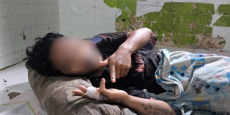 Niat Ingin Mengambil Alas Tidur, Pemuda di Bengkulu Ditusuk 3 Kali oleh Teman Sendiri
