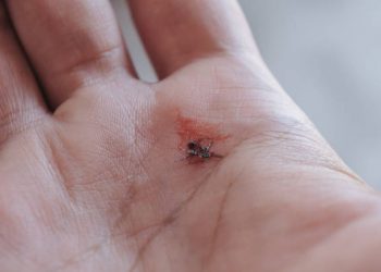 Lagi Sakit DBD? Coba Konsumsi 5 Jenis Buah Ini, Bisa Tingkatkan Trombosit