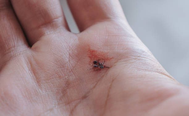 Lagi Sakit DBD? Coba Konsumsi 5 Jenis Buah Ini, Bisa Tingkatkan Trombosit