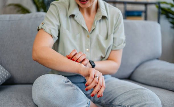 Waspadai! Ada 5 Gejala Umum Penyakit Biduran, Salah Satunya Sensasi Panas pada Kulit